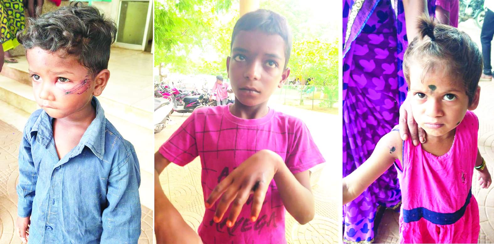 గాయాలైన చిన్నారులు