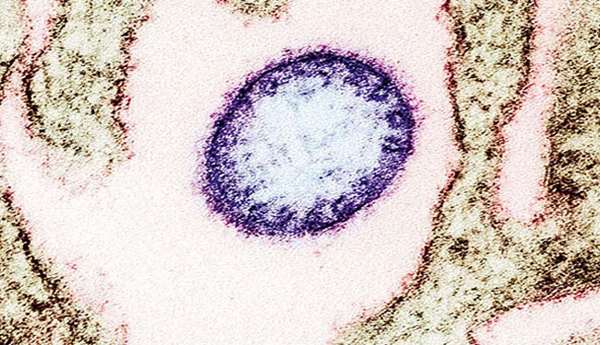 Nifa-virus-again-in-Kerala