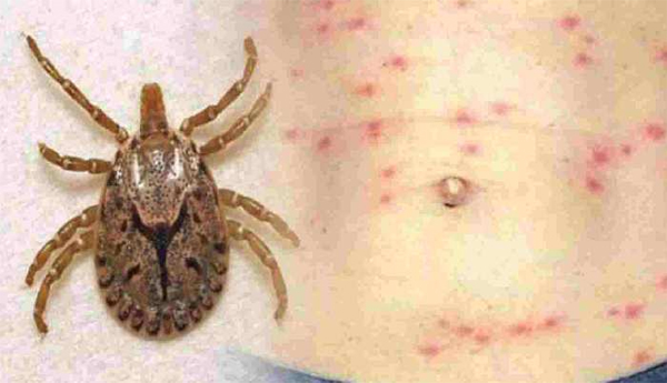 Scrub-typhus-shaking-Odisha