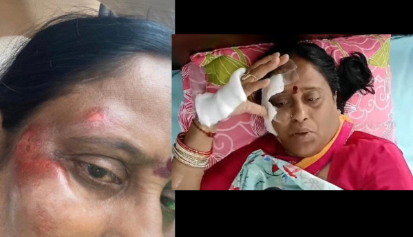 రాహుల్‌ గాంధీ ర్యాలీలో కొండా సురేఖకు గాయాలు