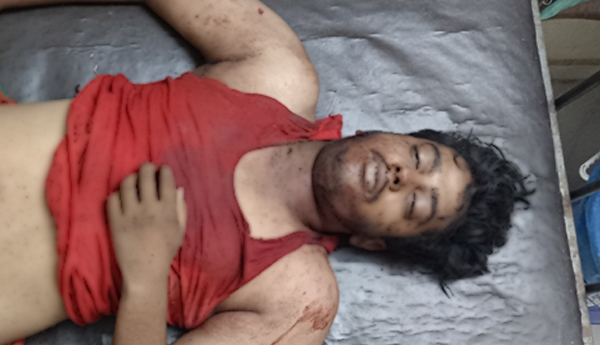 death-by-road-accident.