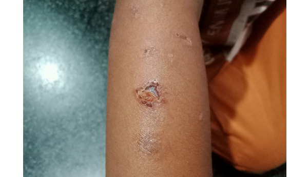 monkey-attack-on-child.