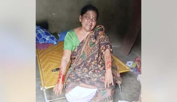 మహిళపై చిరుత దాడి