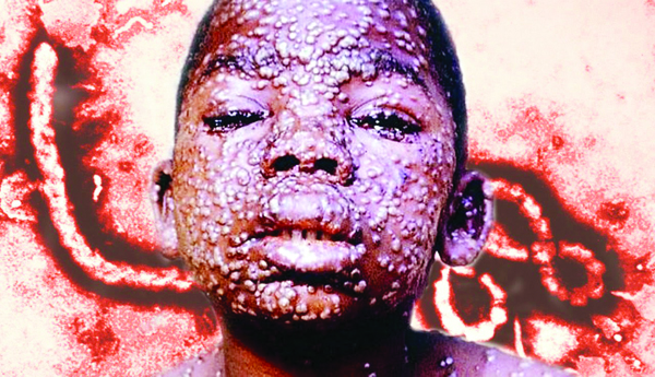 వ్యాక్సిన్‌.. ఎప్పుడు ? ఎక్కడీ ఎలా ?