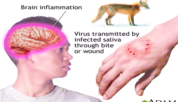 వ్యాక్సిన్‌.. ఎప్పుడు ? ఎక్కడీ ఎలా ?